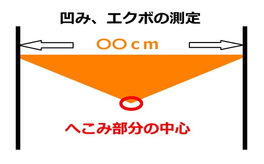 エクボ・凹みの測定方法